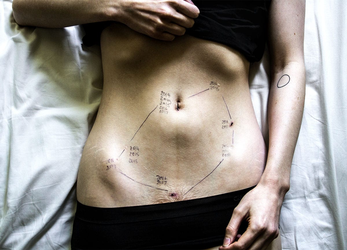 The Flex guide to endometriosis & how it affects your period