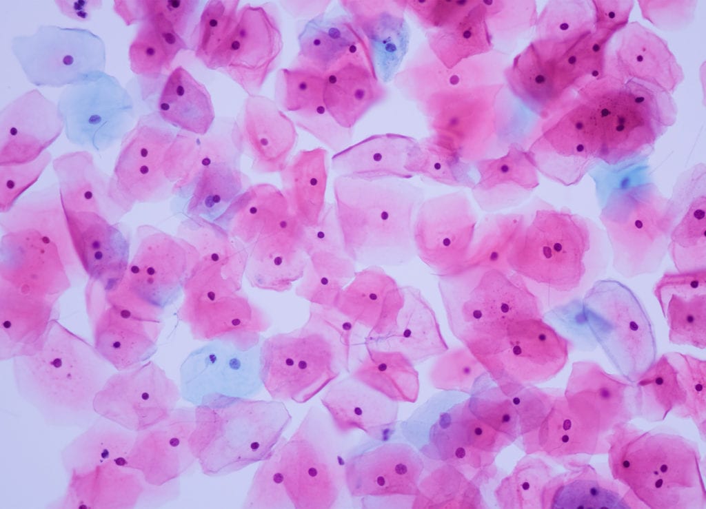 cervical cells under a microscope