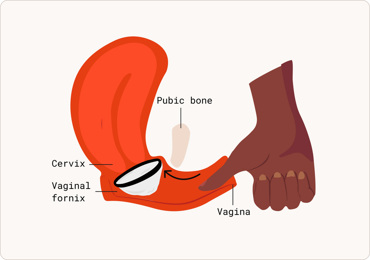 How to use a menstrual disc: Insertion & removal | Flex® Modern Period Care