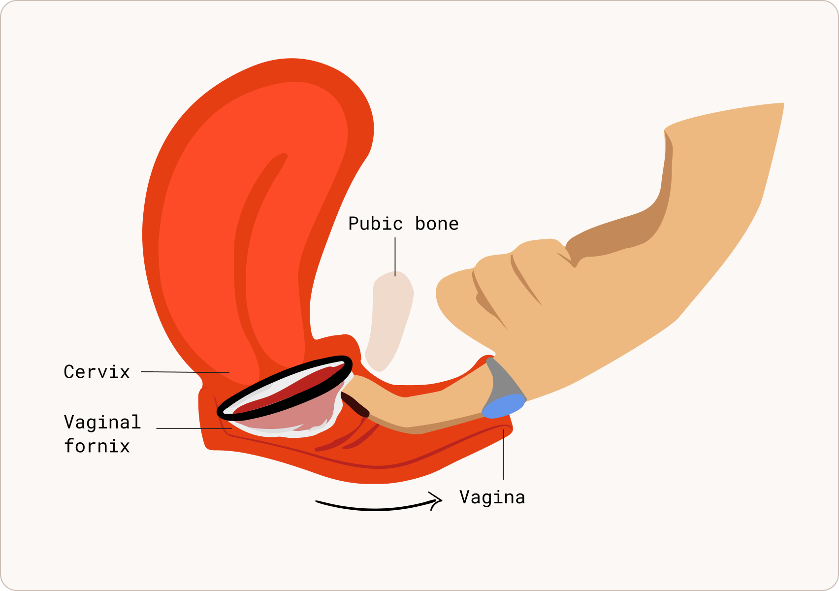 Bear down for easier removal