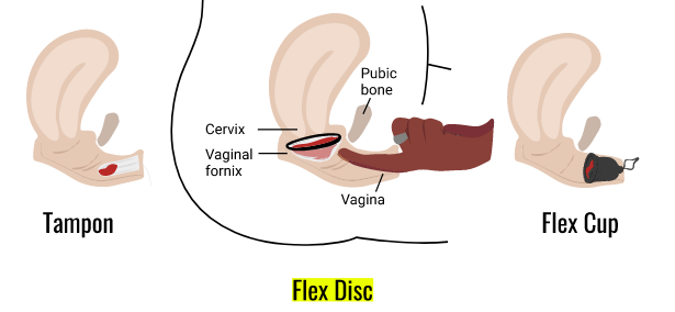 Flex Menstrual Disc insertion Diagram
